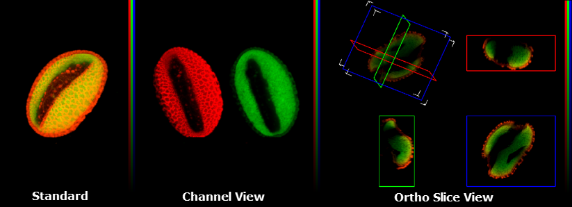 Standard, Channel and Ortho Slice View Example